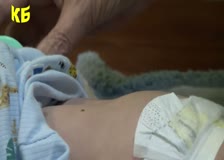 В Ботевград няма регистрирани случаи на морбили, уличени е заболеваемостта от други вирусни инфекции